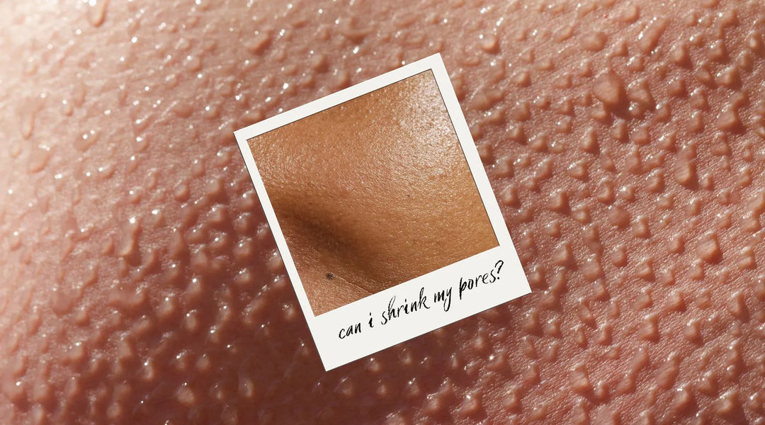 Can I Shrink My Pores, Please?