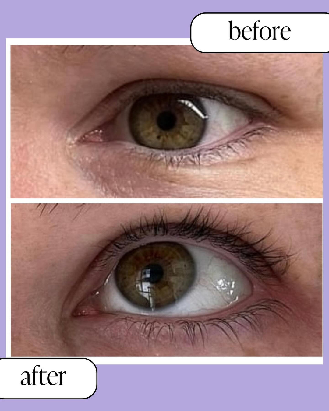 Before and after results of using Siren Eyelash Growth Serum, showing a noticeable difference in eyelash length and thickness on a close-up of an eye.