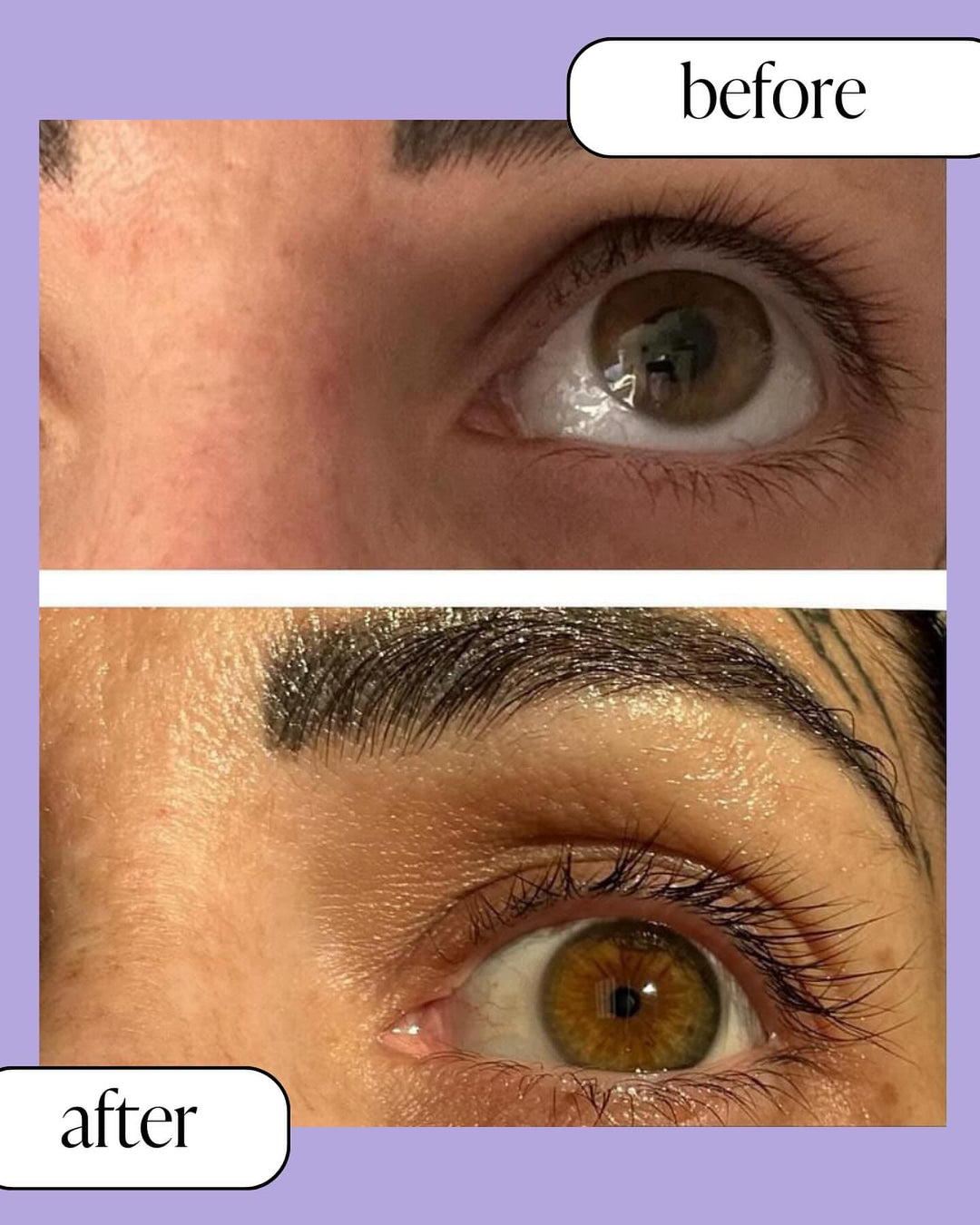 Before and after results of using Siren Eyelash Growth Serum, visible increase in eyelash length and thickness on a close-up of an eye. Eyelash growth, natural serum