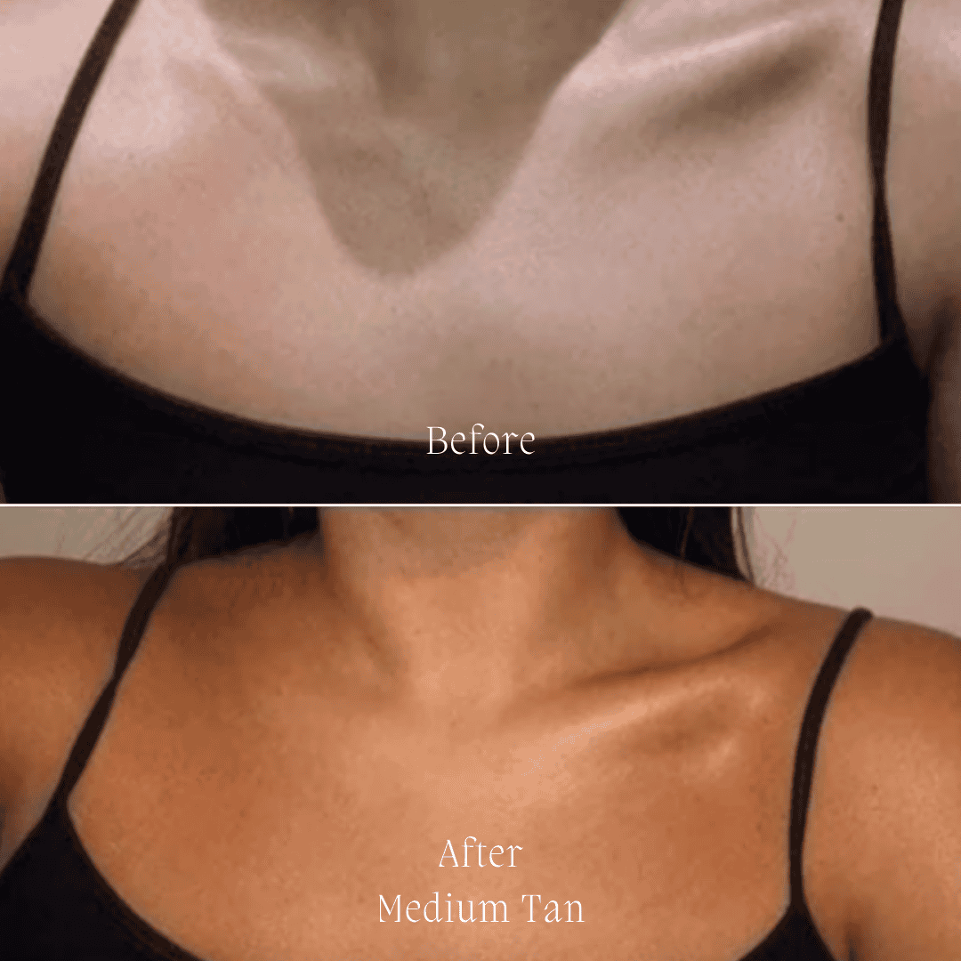 Before and after image showing the medium tan result of Surf & Body Summer Glow Hyaluronic Tanning Drops on a woman's chest, highlighting the product's natural bronzing effect.