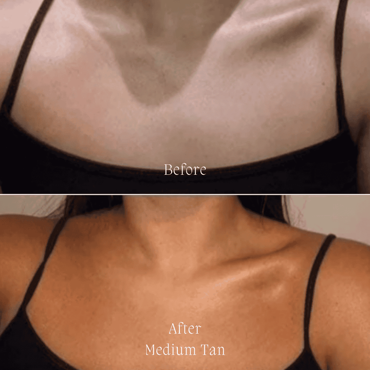 Before and after image showing the medium tan result of Surf & Body Summer Glow Hyaluronic Tanning Drops on a woman's chest, highlighting the product's natural bronzing effect.